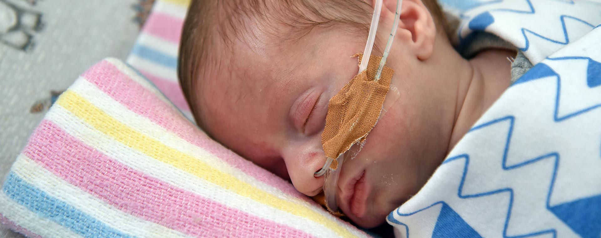 Baby with Oxygen Tubes