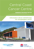 Radiotherapy for oesophageal cancer